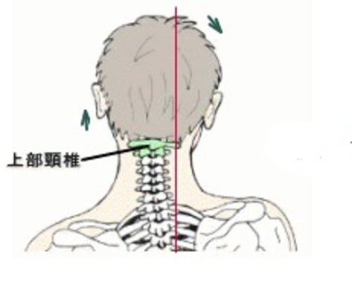 上部頸椎カイロプラクティック