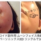 あらゆる肌悩みを解消！魔法の美容液！リンクルローション