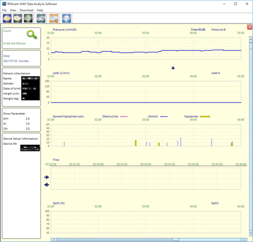 オートＣＰＡＰ