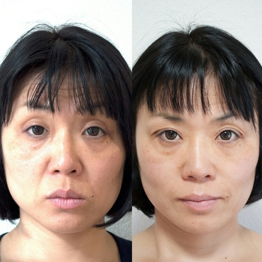 先着5名限定 小顔矯正の格安体験キャンペーン たった１回で小顔になりシンメトリーに近ずきます Hiro 武蔵浦和のその他の無料広告 無料掲載の掲示板 ジモティー