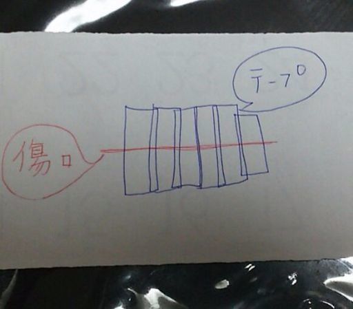 帝王切開後の傷用テープ なな 横浜のマタニティ用品の中古あげます 譲ります ジモティーで不用品の処分 帝王切開後の傷用テープ なな 横浜のマタニティ用品の中古あげます 譲ります ジモティーで不用品の処分