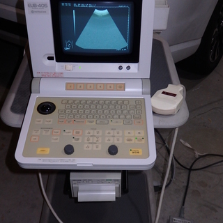 日立の超音波画像診断装置 EUB-405