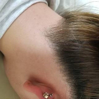 完全個室のプライベート脱毛サロン Lagoon 富士の脱毛の無料広告 無料掲載の掲示板 ジモティー