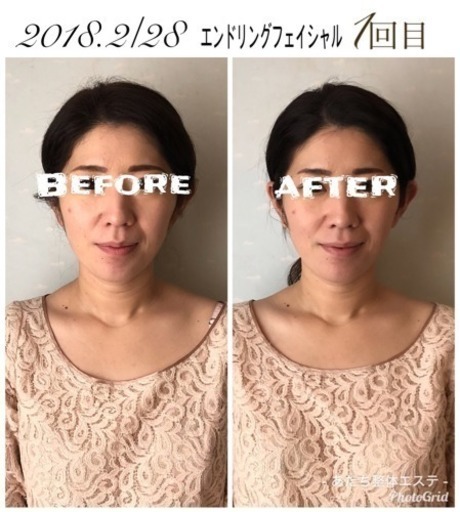学生半額 痛くない小顔矯正エンドリングフェイシャル あだち整体エステ 城野のその他の無料広告 無料掲載の掲示板 ジモティー