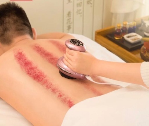 刮痧 走罐 悪血と老廃物を流すのだ 男性の方も大歡迎 茉莉 おもろまちの整体の無料広告 無料掲載の掲示板 ジモティー 刮痧 走罐 悪血と老廃物を流すのだ 男性の方も大歡迎 茉莉 おもろまちの整体の無料広告 無料掲載の掲示板 ジモティー