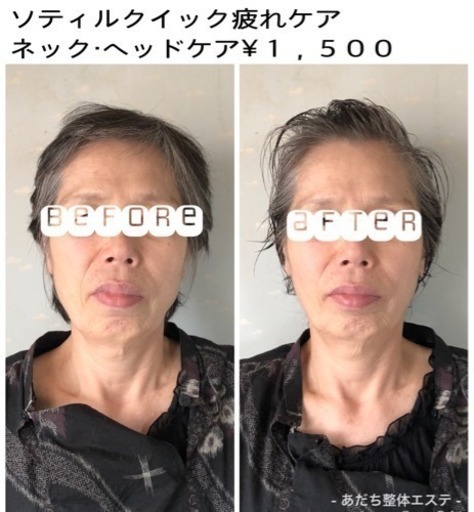 脳疲労むくみを取り去りお顔もリフトアップ ソティルクイック疲れケア あだち整体エステ 城野のその他の無料広告 無料掲載の掲示板 ジモティー
