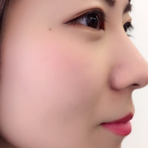 なんと 毎日2名様限定 美白毛穴美顔トリートメント美白パック込み 1404円 ゚ ゚ 黒ずんだ毛穴スッキリします 毛穴の汚れ実際に しみず 宮内串戸のその他の無料広告 無料掲載の掲示板 ジモティー