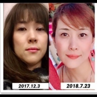 今流行りのstemcellvivi ヒト幹細胞培養美容液 コスメ/ヘルスケア 