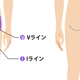 【ご新規様男性限定】ＶＩＯ脱毛モニター募集！好評につき再募集♪