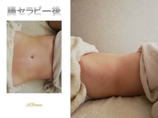 腸セラピーでぽっこりお腹をぺっこりお腹に あ ろまん 流山おおたかの森のその他のイベント参加者募集 無料掲載の掲示板 ジモティー