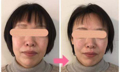 まったく痛くない 気持ちいい小顔矯正で1回で効果が実感できます Keiko 金沢のキャンペーンのイベント参加者募集 無料掲載の掲示板 ジモティー まったく痛くない 気持ちいい小顔矯正で1回で効果が実感できます Keiko 金沢のキャンペーンのイベント参加者募集 無料掲載の掲示板 ジモティー