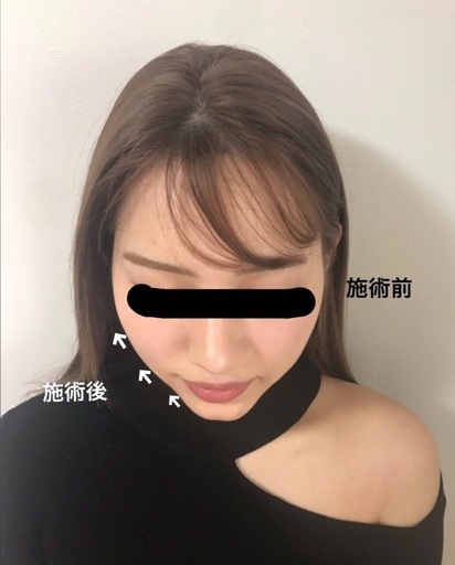 頭蓋骨小顔矯正 首肩リンパ 60分オイル付き Star Esthe つくばのその他の無料広告 無料掲載の掲示板 ジモティー 頭蓋骨小顔矯正 首肩リンパ 60分オイル付き Star Esthe つくばのその他の無料広告 無料掲載の掲示板 ジモティー