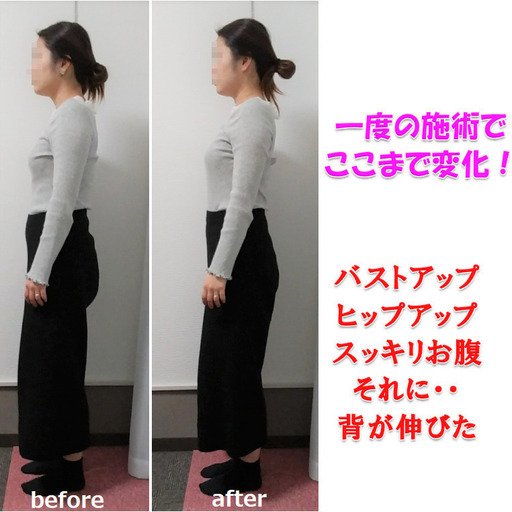 姿勢矯正60 Off バストアップ ヒップアップ 初回限定交野市枚方市寝屋川市 功心道 河内磐船のその他の無料広告 無料掲載の掲示板 ジモティー