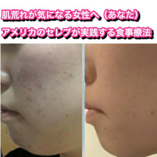 痩せたくない人も痩せてしまう食事方法 ドミノ 渋谷の美容健康の生徒募集 教室 スクールの広告掲示板 ジモティー 痩せたくない人も痩せてしまう食事方法 ドミノ 渋谷の美容健康の生徒募集 教室 スクールの広告掲示板 ジモティー