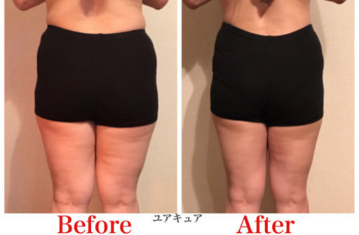 難しい脚やせも3ヶ月で 6 4センチ シオガイアキ 武里の美容の無料広告 無料掲載の掲示板 ジモティー