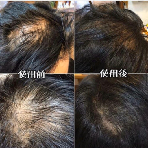 30%オフ　マトリックスエキススカルプケアシャンプー\u0026コンディショナーセット