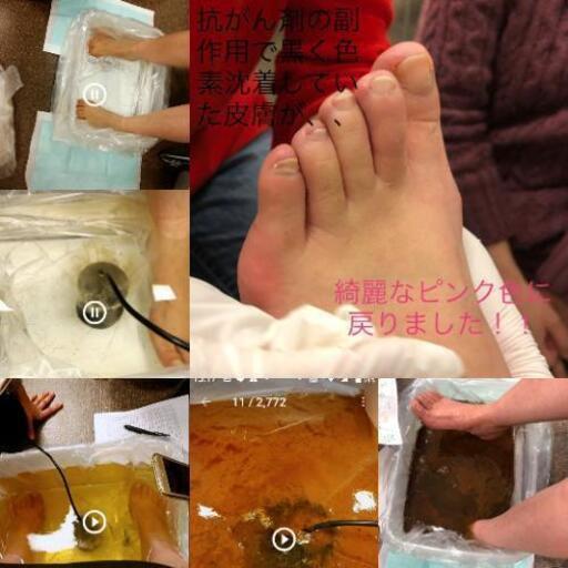 アイオニックフットバスデトックス Tomo 板橋本町のワークショップのイベント参加者募集 無料掲載の掲示板 ジモティー