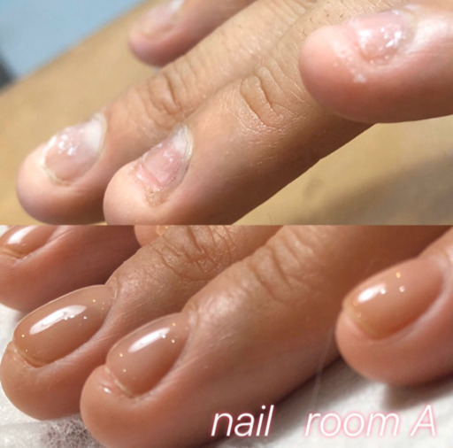 美爪に導く 深爪緩和 自爪育成サロン 爪育ネイリスト 青森のネイルの無料広告 無料掲載の掲示板 ジモティー