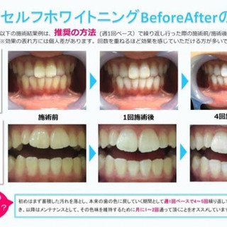 堺市深井 ホワイトニングサロン Salon Remi 深井のその他の無料広告 無料掲載の掲示板 ジモティー 堺市深井 ホワイトニングサロン Salon Remi 深井のその他の無料広告 無料掲載の掲示板 ジモティー
