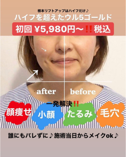 小顔 リフトアップ 最高峰ハイフが受けれる Aya 宇美の美容の無料広告 無料掲載の掲示板 ジモティー 小顔 リフトアップ 最高峰ハイフが受けれる Aya 宇美の美容の無料広告 無料掲載の掲示板 ジモティー