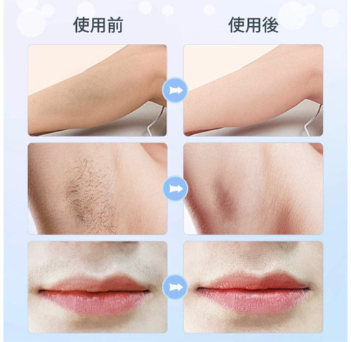 Yapafa脱毛器の口コミと使い方 家庭用脱毛器は安いものでも効果あるか使ってみた