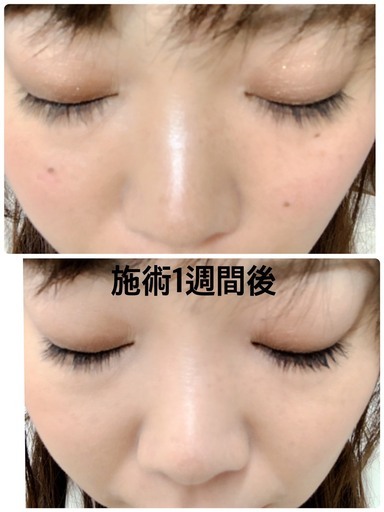 シミケアお試し3カ所 990 税込 キャンペーン中 弘明寺駅から2分 Babyface 弘明寺のエステの無料広告 無料掲載の掲示板 ジモティー シミケアお試し3カ所 990 税込 キャンペーン中 弘明寺駅から2分 Babyface 弘明寺のエステの無料広告 無料掲載の掲示板 ジモティー