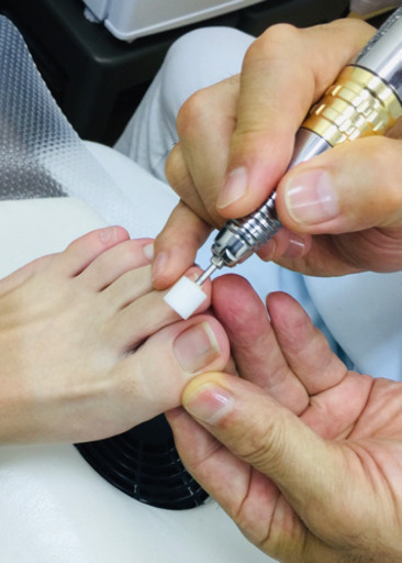 割れた爪を綺麗に補修します 参考投稿 あしまるくん 吉野町のボディケアの無料広告 無料掲載の掲示板 ジモティー