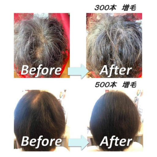 埼玉増毛エクステ エアエク 女性の薄毛対策 髪のボリュームアップ さいたま市大宮区堀の内町 初回50 Off Ayako 北大宮のその他の無料広告 無料掲載の掲示板 ジモティー 埼玉増毛エクステ エアエク 女性の薄毛対策 髪のボリュームアップ さいたま市大宮区堀の内町 初回50 Off Ayako 北大宮のその他の無料広告 無料掲載の掲示板 ジモティー