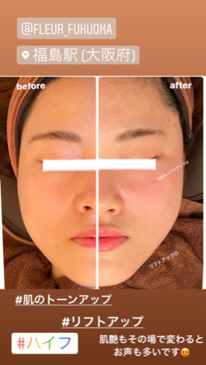 医療提携サロン 最新美容リフトアップマシンモニター募集 5 000円3 000ショット 大平奈津希 福島のその他の無料広告 無料掲載の掲示板 ジモティー