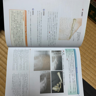 骨折　髄内固定治療マイスター　中古