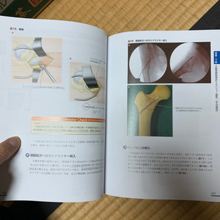 骨折　髄内固定治療マイスター　中古
