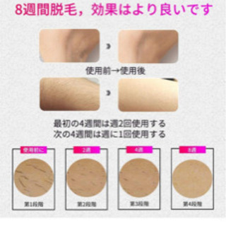 脱毛器  50万回照射 レーザー脱毛器 光脱毛器 IPL 5段階調節　脇 全身脱毛 男女兼用　日本語説明書付き（ピンク）