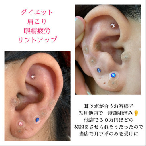 耳ツボジュエリー 耳ツボダイエット Churaku 沖縄の美容の無料広告 無料掲載の掲示板 ジモティー
