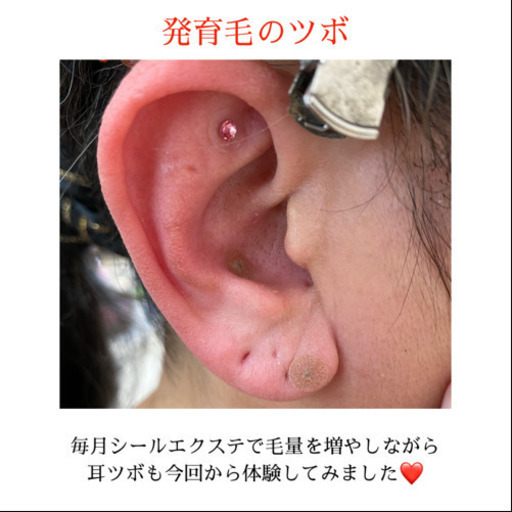 耳ツボジュエリー 耳ツボダイエット Churaku 沖縄の美容の無料広告 無料掲載の掲示板 ジモティー