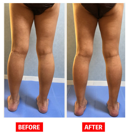 美脚モニター大大募集です 結果重視 オトナ女性 のむくみ セルライト除去 自信の美脚へ理想のお身体は自分次第 Miray 忍ケ丘のその他の無料広告 無料掲載の掲示板 ジモティー