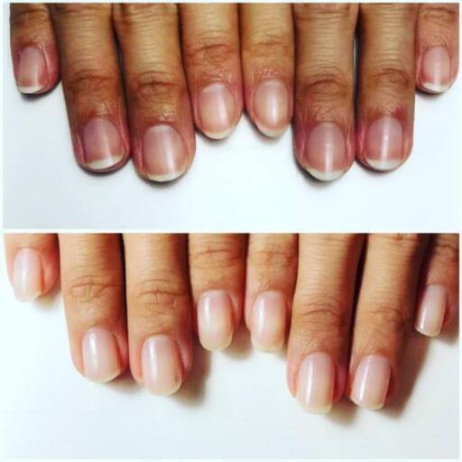 自爪育成 深爪育成専門ネイルサロン パグ 王子公園のネイルの無料広告 無料掲載の掲示板 ジモティー