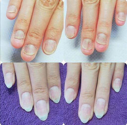 ネイルサロン 巻爪矯正 深爪矯正 Aby Nail 栗平のネイルの無料広告 無料掲載の掲示板 ジモティー