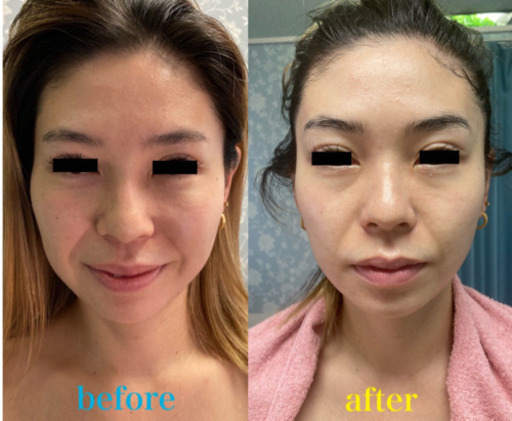 フェイシャルと痩身モニター募集 1周年記念 大阪北区中崎町 Kaori 大阪のその他の無料広告 無料掲載の掲示板 ジモティー フェイシャルと痩身モニター募集 1周年記念 大阪北区中崎町 Kaori 大阪のその他の無料広告 無料掲載の掲示板 ジモティー