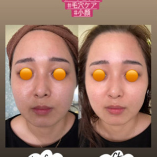 フェイシャルと痩身モニター募集 1周年記念 大阪北区中崎町 Kaori 大阪のその他の無料広告 無料掲載の掲示板 ジモティー フェイシャルと痩身モニター募集 1周年記念 大阪北区中崎町 Kaori 大阪のその他の無料広告 無料掲載の掲示板 ジモティー