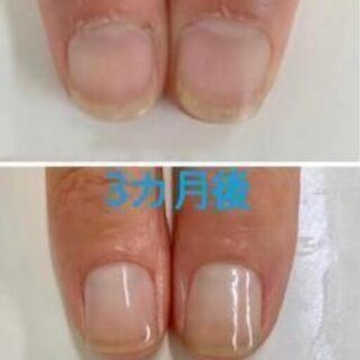 残り1名です 日曜日 地爪育成モニター募集 1回2500円溝の口徒歩3分 Nyarnail 武蔵溝ノ口の手伝って 助けての助け合い ジモティー
