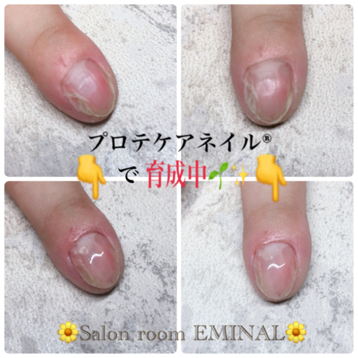 自爪育成お試し価格笠間市 Eri 笠間の美容の無料広告 無料掲載の掲示板 ジモティー 自爪育成お試し価格笠間市 Eri 笠間の美容の無料広告 無料掲載の掲示板 ジモティー