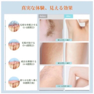 新品・未使用】【最新式 サファイア氷感脱毛器】honeyview レーザー 