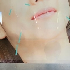 美容鍼モニター募集❗️ 明日12/1（水）1名様限定