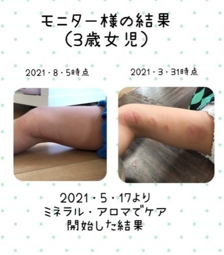 子どものアトピーどうにかしたい アトピっ子ママのための専門サロンcomodomama コモドママ えまっこ 神鉄六甲のその他の無料広告 無料掲載の掲示板 ジモティー