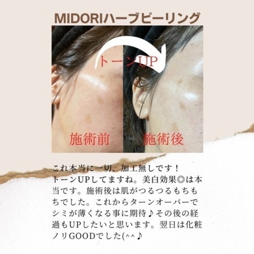 碧MIDORI ハーブピーリング 2回分　説明書付