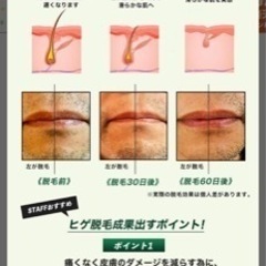 【未使用】脱毛器＆フォトフェイシャル美顔器