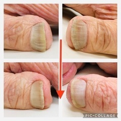 4ヶ月振りの自爪(手と足)ケア❗️爪スッキリ‼️