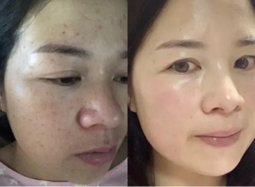 無シミ すっぴん美人なりたい彼女必見 東洋経絡 おもろまちのその他の無料広告 無料掲載の掲示板 ジモティー