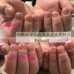 【クリアジェル補強】深爪改善ネイルpalnail