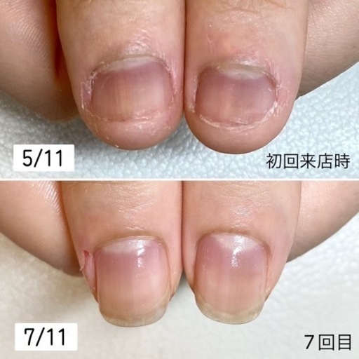 ネイルケアのみで地爪を縦長の美爪にする育成モニター様募集 3ヶ月間集中コース 5名様限定 残枠1名様です Smile 豊橋のネイルの無料広告 無料掲載の掲示板 ジモティー ネイルケアのみで地爪を縦長の美爪にする育成モニター様募集 3ヶ月間集中コース 5名様限定 残枠1名様です Smile 豊橋のネイルの無料広告 無料掲載の掲示板 ジモティー